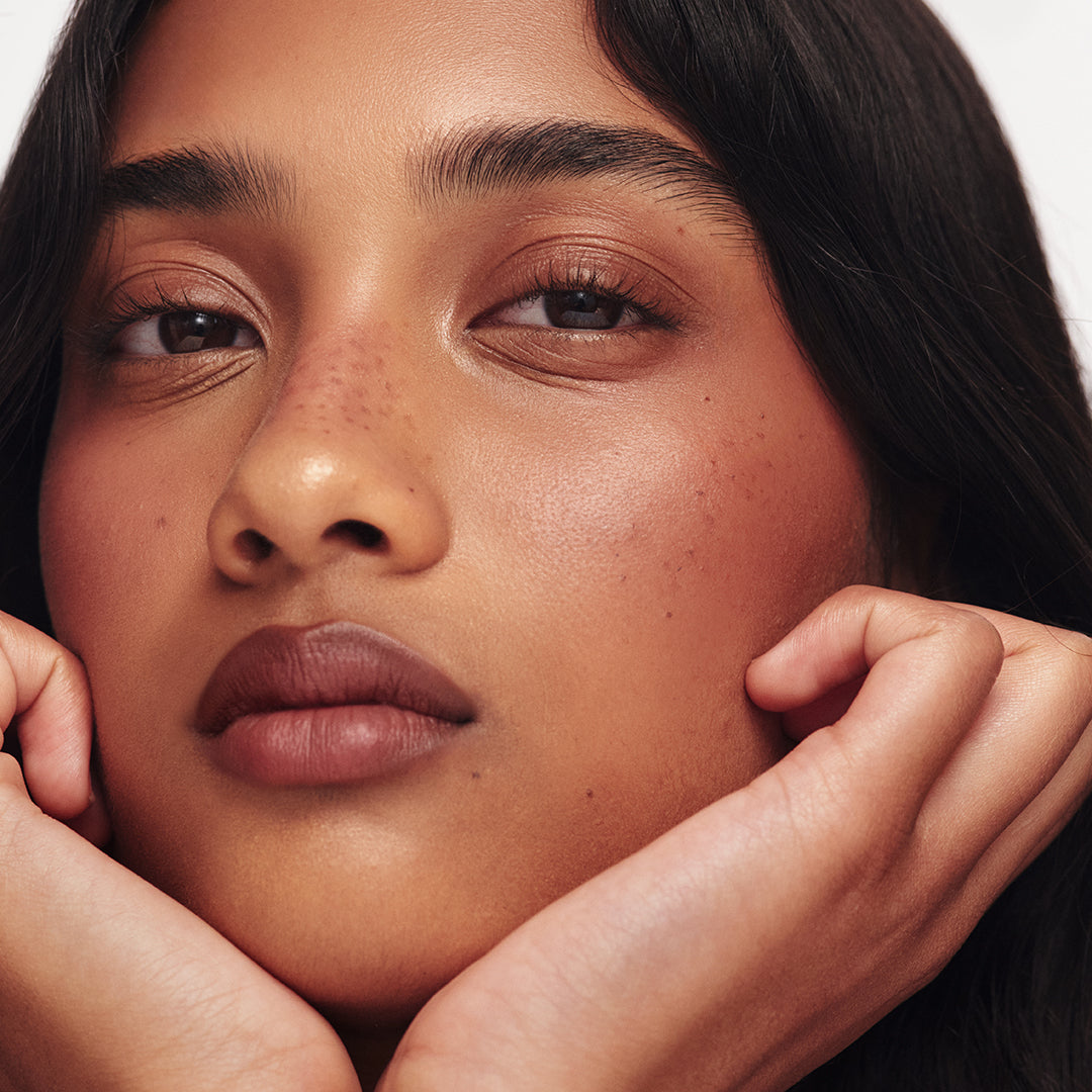 Freckle Bambi