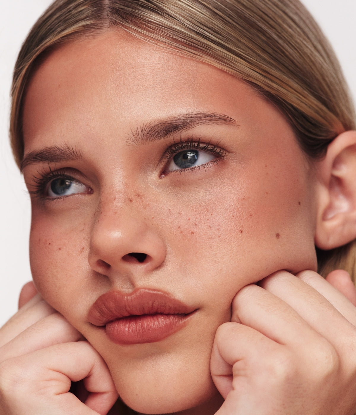 Freckle