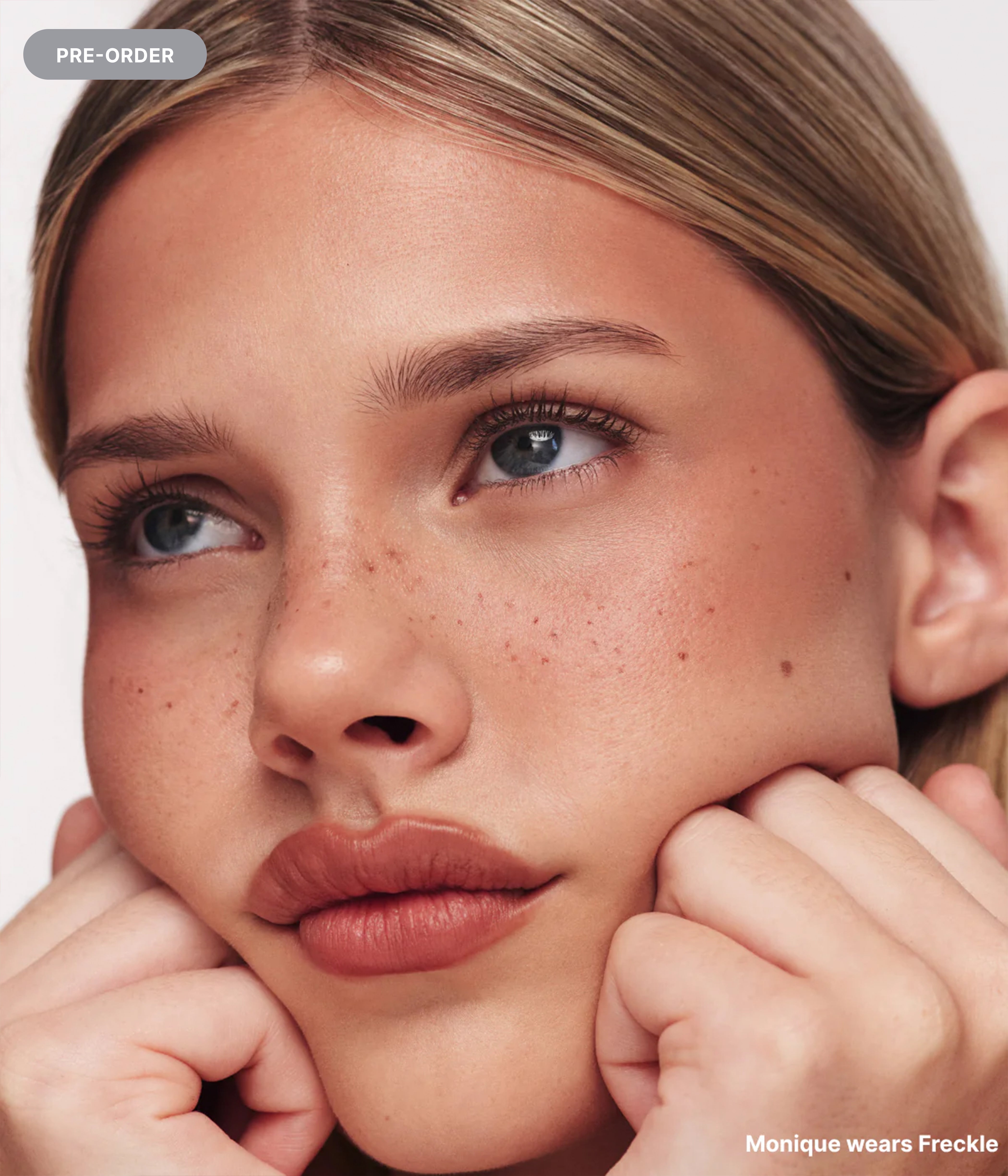 Freckle